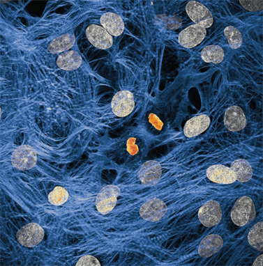 сердечная мышца